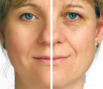 Botox Near Me Rockville - What Botox Does to Your Skin