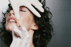 What are the benefits of Belotero dermal filler