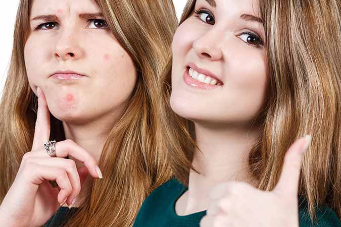 fight acne is with your dermatologist