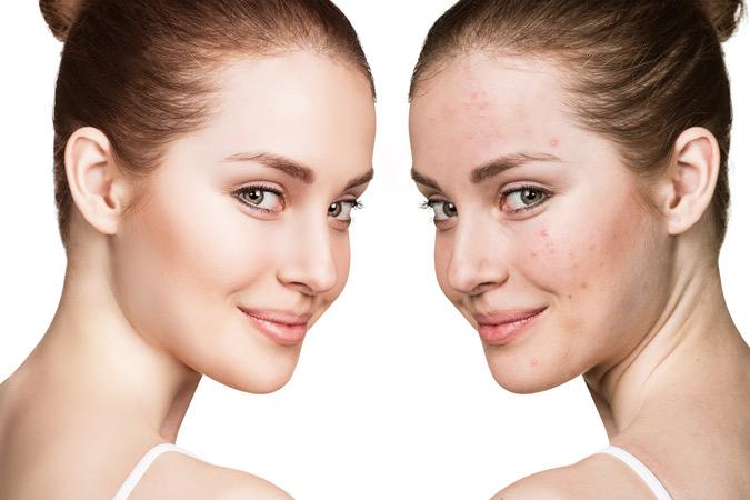 Dr Ronald B. Prussick, Washington Dermatology Center Providing Anti Aging Treatment in Rockville