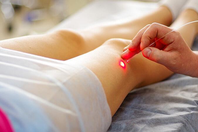 Laser Skin Care Rockville MD