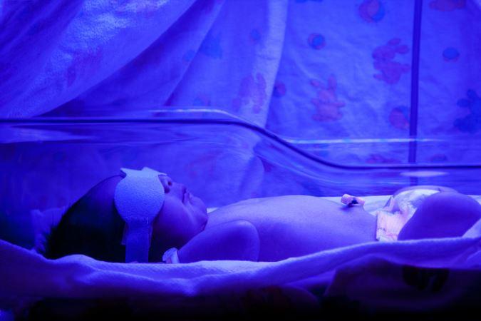 Phototherapy treatment from dermatologist in Kensington