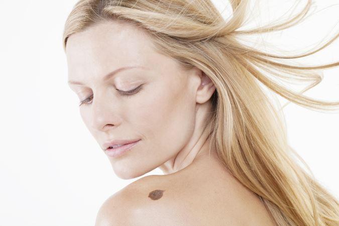 Prevention From Skin Cancer from dermatologist Germantown