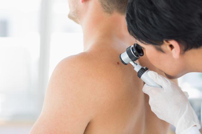 what is skin cancer learn more from dermatologist in silver spring