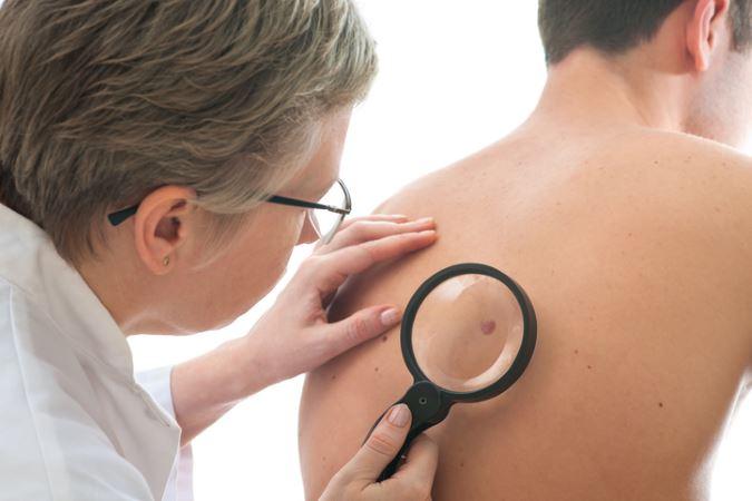 Rockville, MD doctor describes skin cancer