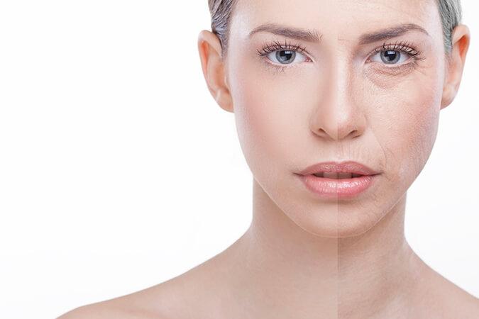 Treatment for Rosacea Frederick