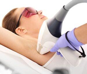 Permanent Hair Reduction