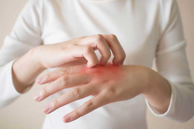 Relieve the redness and itch with customized eczema treatment