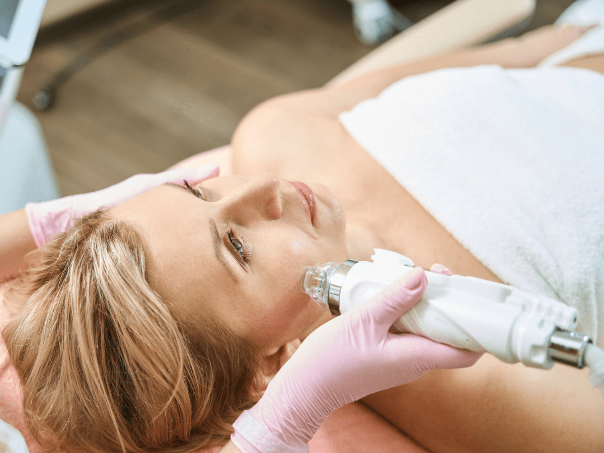 microneedling treatment